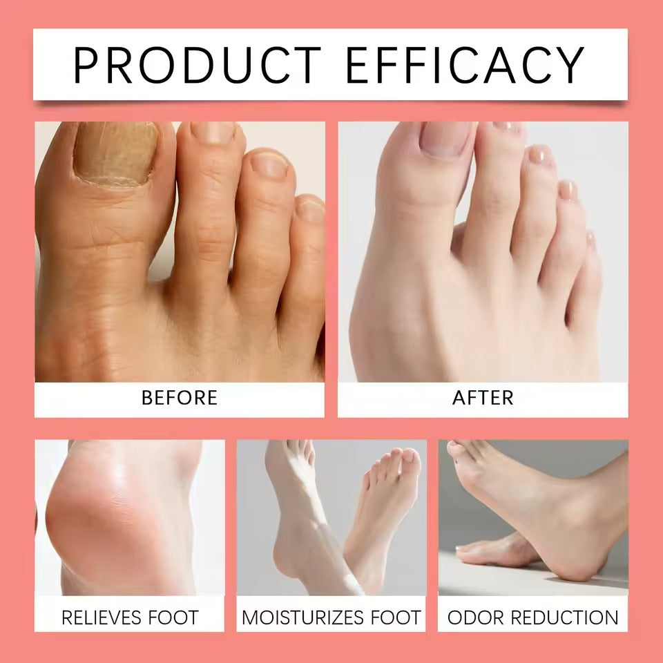 Deep Exfoliating Foot Peel Mask